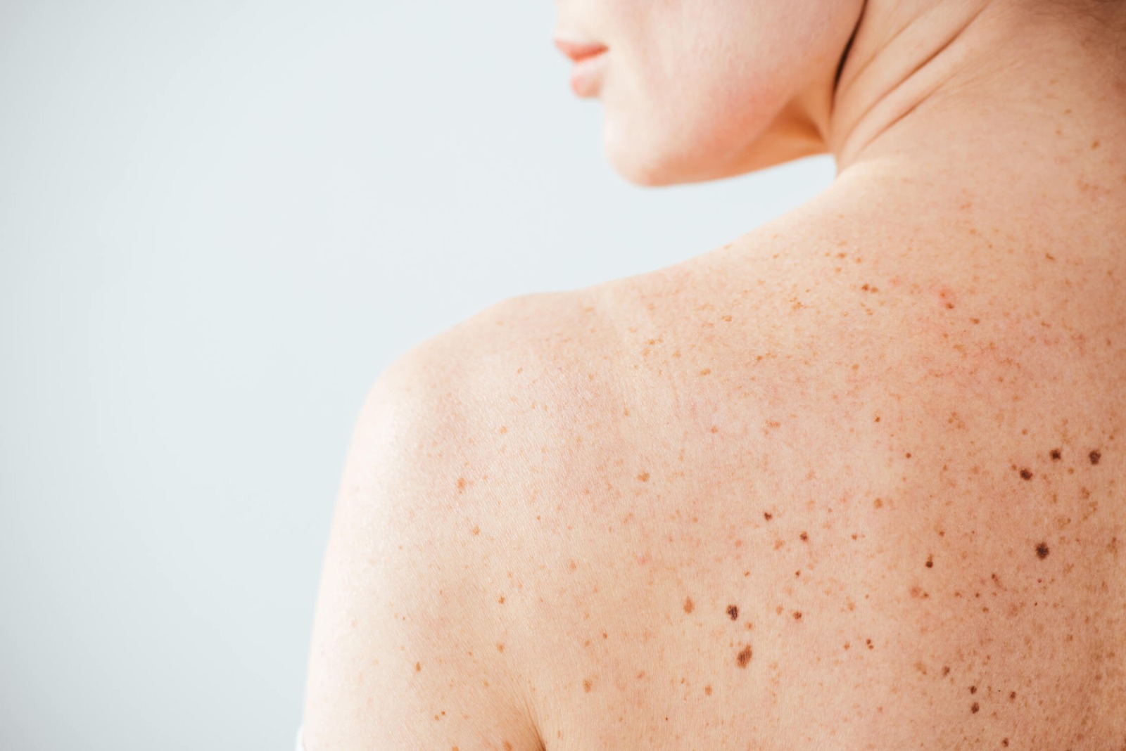 Dermatologie