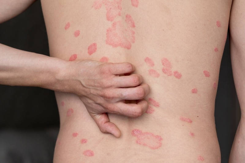 Algemene dermatologie
