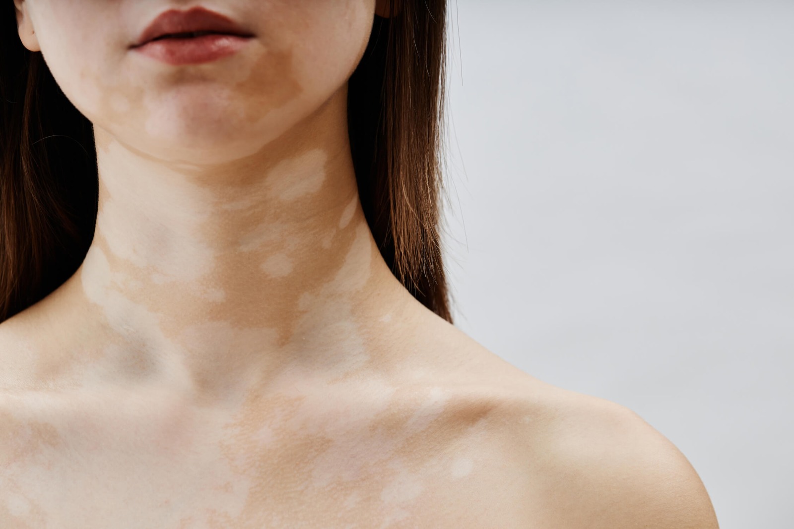Dermatologie