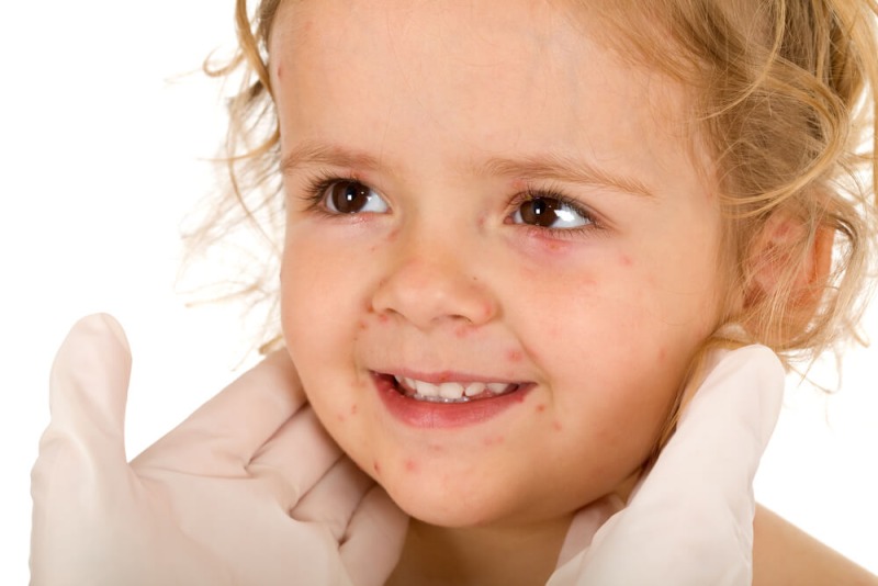 Kinderdermatologie