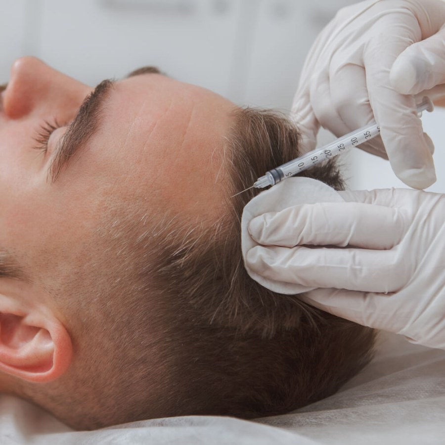 Hair and scalp