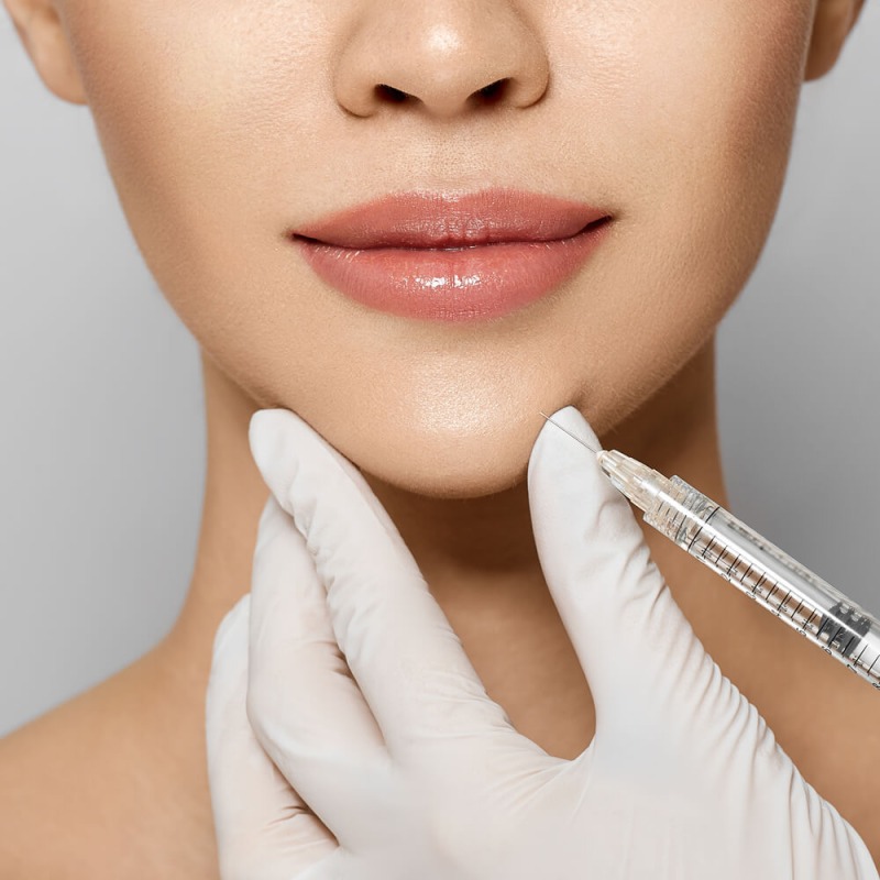 Hyaluronzuur fillers