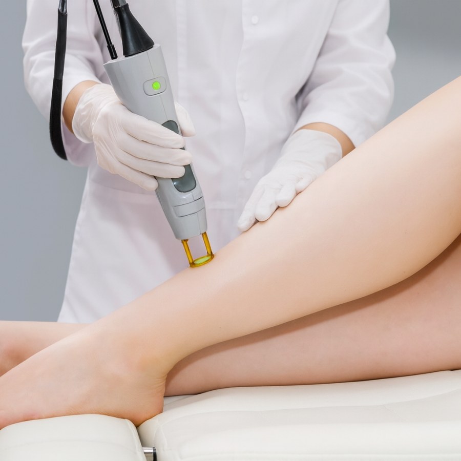 Épilation au laser