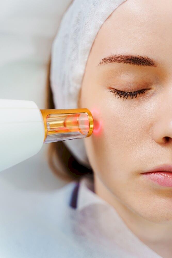 Consultatie laserbehandeling
